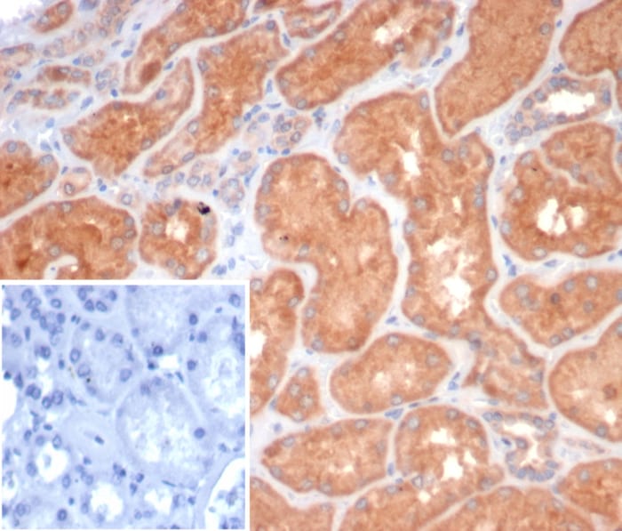 S100G Antibody (S100G/7462)