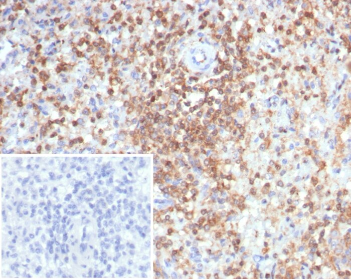 S100G Antibody (S100G/7516)