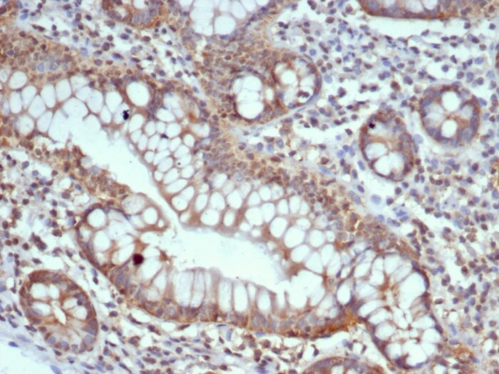 S100G Antibody (S100G/7516)