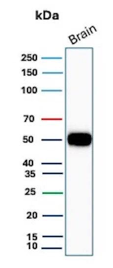 GFAP Antibody (GFAP/8615R) Western Blot: GFAP Antibody (GFAP/8615R) [NBP3-23869] -