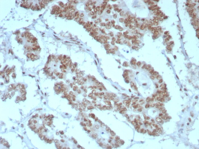 SNF5 Antibody (rINI1/8850)