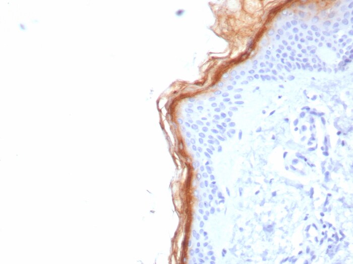 S100G Antibody (S100G/7517)