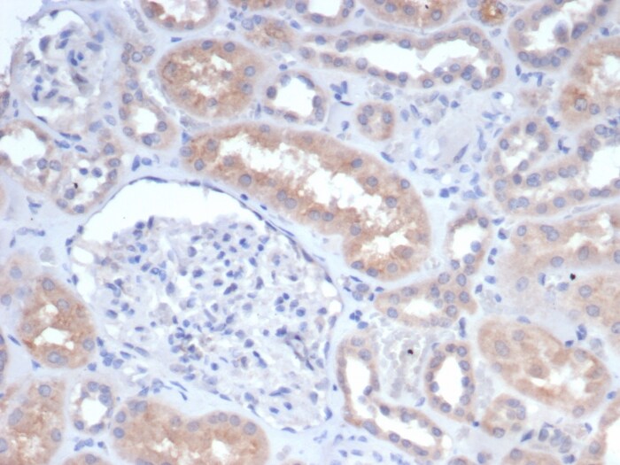 GCLM Antibody (GCLM/4068)