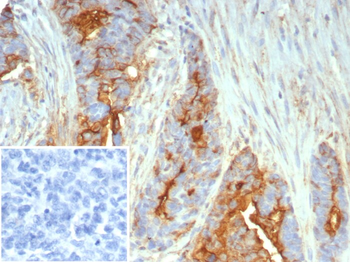 MUC1 Antibody (MUC1/7797R)