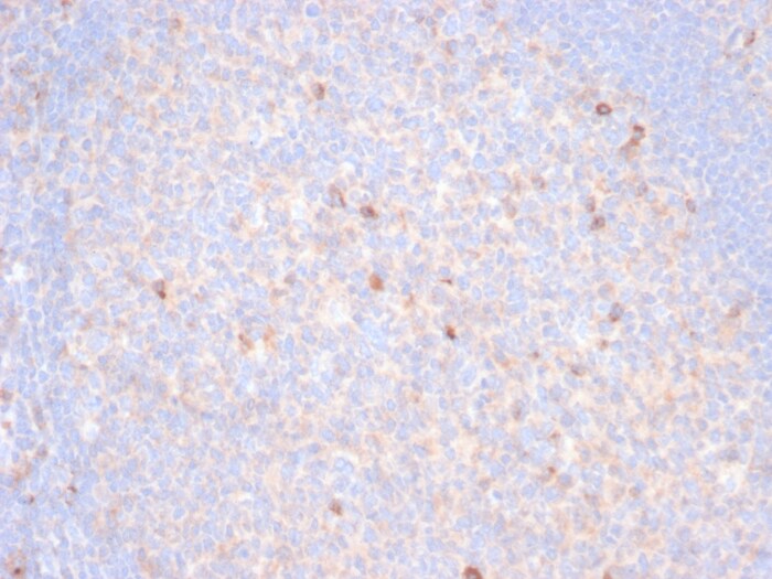 TIM-3 Antibody (TIM3/6863R)