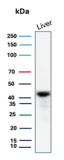 Glutamine Synthetase Antibody (rGLUL/8620) Western Blot: Glutamine Synthetase Antibody (rGLUL/8620) [NBP3-23897] -