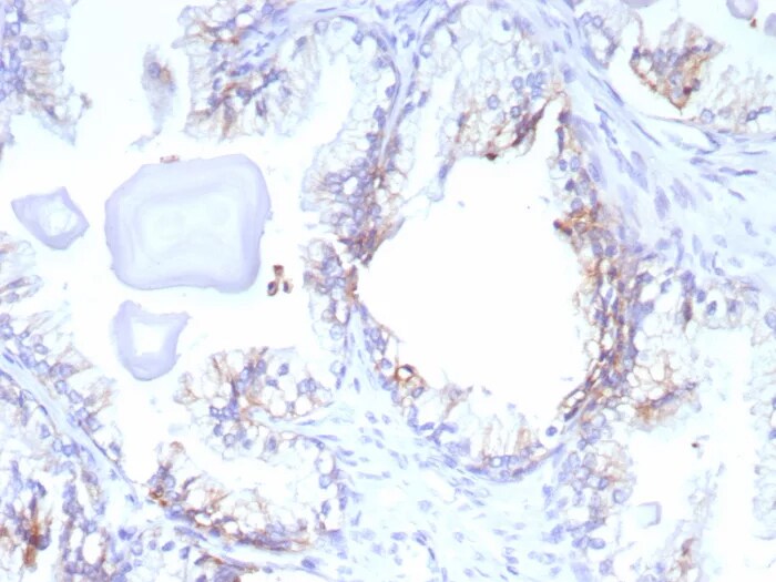 MRP4/ABCC4 Antibody (ABCC4/9179) Immunohistochemistry-Paraffin: MRP4/ABCC4 Antibody (ABCC4/9179) [NBP3-23903] -