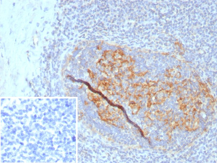 CD35 Antibody (CR1/8284R)