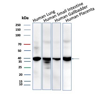 BRAF35 Antibody (BRAF/1323) Western Blot: BRAF35 Antibody (BRAF/1323) [NBP3-23913] -
