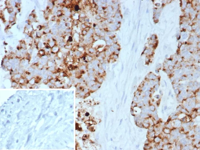 GPRC5A/RAI3 Antibody (GPRC5A/7893) Immunohistochemistry-Paraffin: GPRC5A/RAI3 Antibody (GPRC5A/7893) [NBP3-23915] -