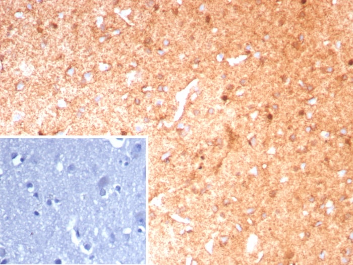 Glutamine Synthetase Antibody (GLUL/8889R)