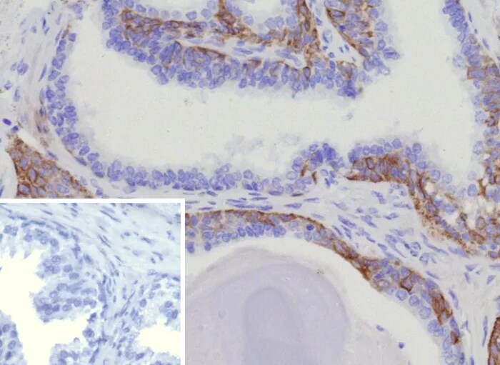 Cytokeratin 15 Antibody (KRT15/9088R) Immunohistochemistry-Paraffin: Cytokeratin 15 Antibody (KRT15/9088R) [NBP3-23919] -