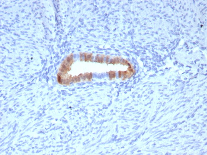 p16INK4a/CDKN2A Antibody (rCDKN2A/8062)