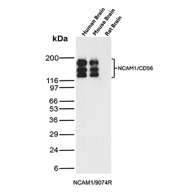 NCAM-1/CD56 Antibody (NCAM1/9074R) Western Blot: NCAM-1/CD56 Antibody (NCAM1/9074R) [NBP3-23922] -
