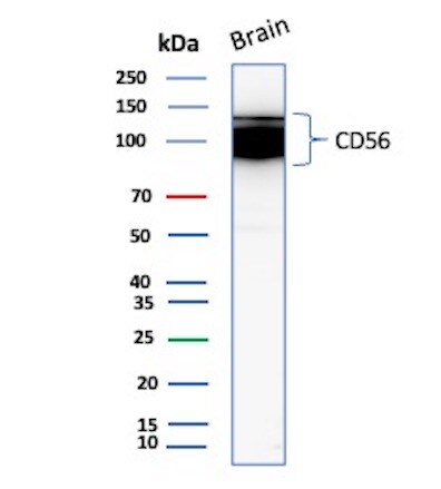NCAM-1/CD56 Antibody (NCAM1/9121R) Western Blot: NCAM-1/CD56 Antibody (NCAM1/9121R) [NBP3-23923] -