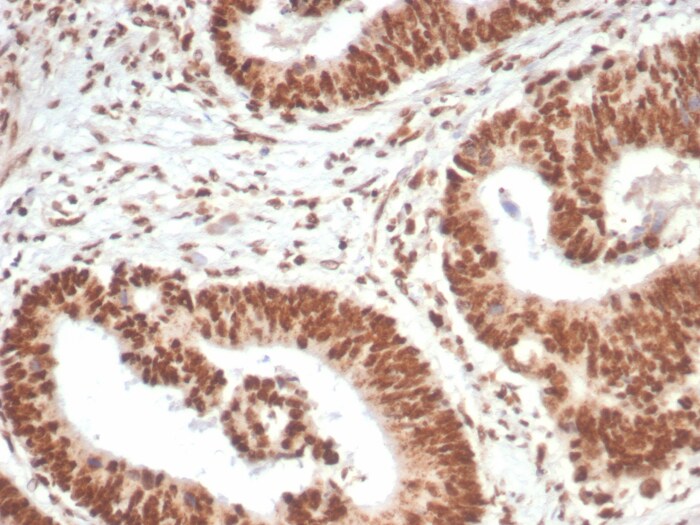 WTAP Antibody (PCRP-WTAP-1A4)