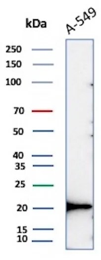 Bax Antibody (BAX/8960R) Western Blot: Bax Antibody (BAX/8960R) [NBP3-23929] -