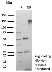 dsDNA Antibody (rDSD/8266)