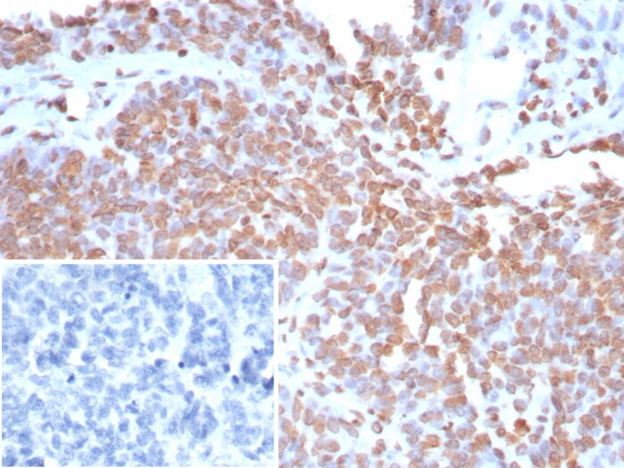 dsDNA Antibody (rDSD/8266)