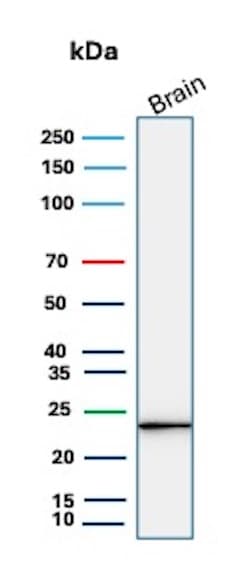 UCH-L1/PGP9.5 Antibody (rUCHL1/8057) Western Blot: UCH-L1/PGP9.5 Antibody (rUCHL1/8057) [NBP3-23932] -