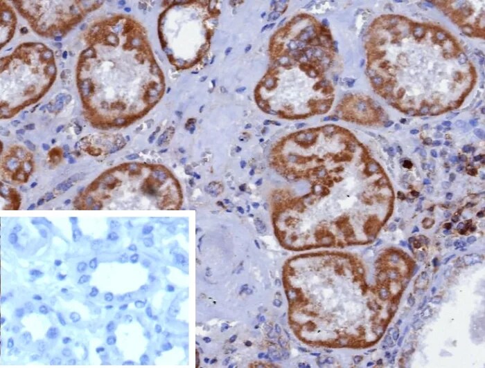 CD7 Antibody (CD7/3868R) Immunohistochemistry-Paraffin: CD7 Antibody (CD7/3868R) [NBP3-23936] -