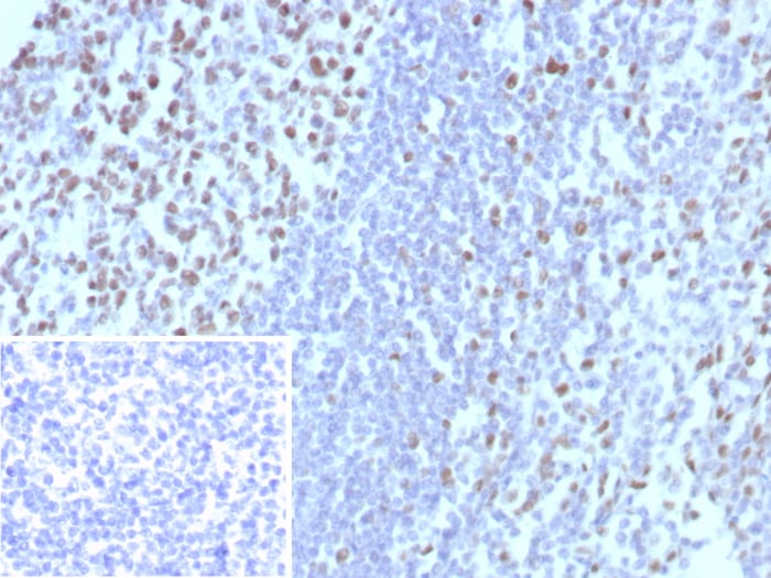 MCM3 Antibody (MCM3/8972R)