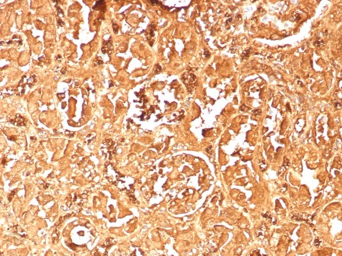Hemoglobin A2 Antibody (rHBA/9167) Immunohistochemistry-Paraffin: Hemoglobin A2 Antibody (rHBA/9167) [NBP3-23944] -