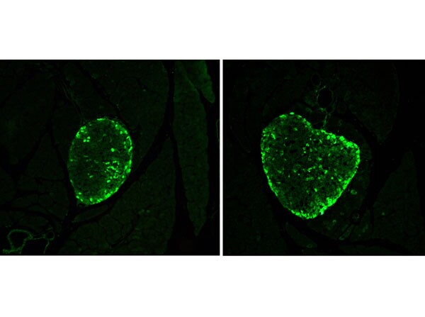 Glucagon Antibody Immunohistochemistry: Glucagon Antibody [NBP3-23954] -
