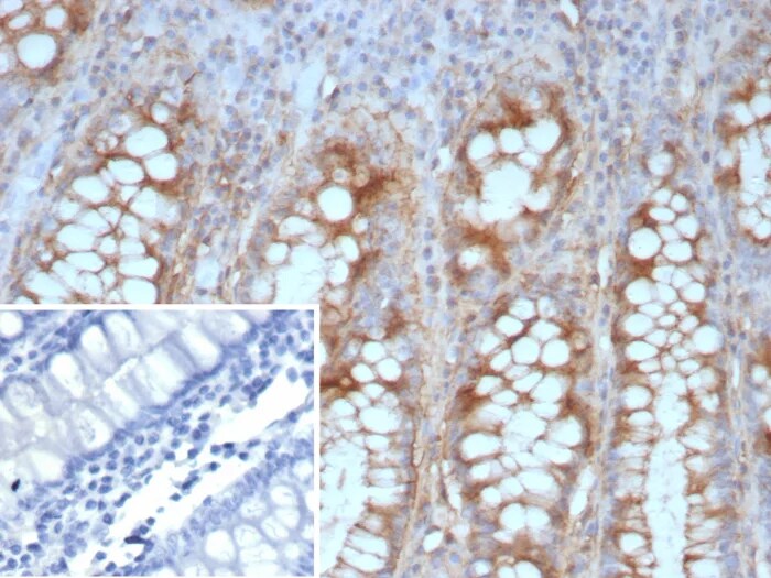 E-Cadherin Antibody (CDH1/9226R) - Azide and BSA Free Immunohistochemistry-Paraffin: E-Cadherin Antibody (CDH1/9226R) - Azide and BSA Free [NBP3-23975] -
