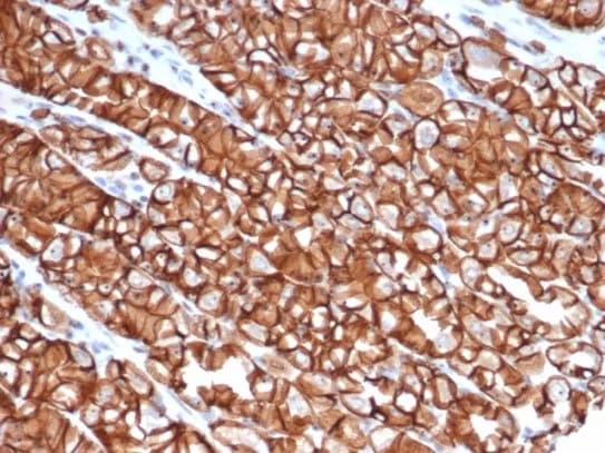 E-Cadherin Antibody (rCDH1/6769) - Azide and BSA Free Immunohistochemistry-Paraffin: E-Cadherin Antibody (rCDH1/6769) - Azide and BSA Free [NBP3-23977] -