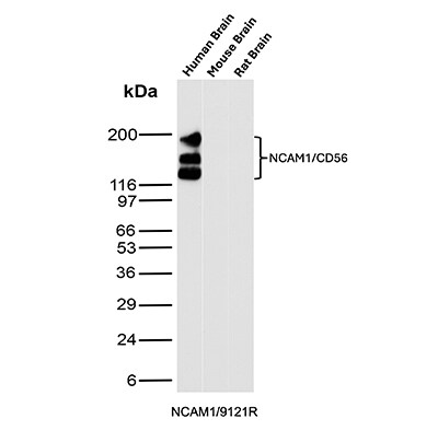NCAM-1/CD56 Antibody (NCAM1/9121R) - Azide and BSA Free Western Blot: NCAM-1/CD56 Antibody (NCAM1/9121R) - Azide and BSA Free [NBP3-23979] -