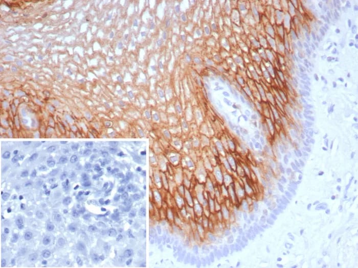 SBSN Antibody (SBSN/7963) - Azide and BSA Free Immunohistochemistry-Paraffin: SBSN Antibody (SBSN/7963) - Azide and BSA Free [NBP3-23983] -
