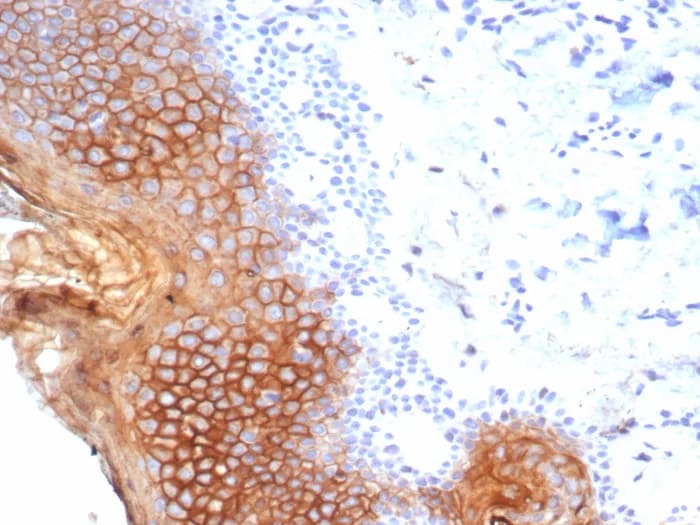 SBSN Antibody (SBSN/7965) - Azide and BSA Free Immunohistochemistry-Paraffin: SBSN Antibody (SBSN/7965) - Azide and BSA Free [NBP3-23984] -