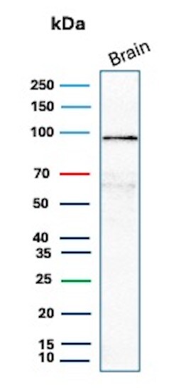 beta-Catenin Antibody (CTNNB1/8280R) - Azide and BSA Free Western Blot: beta-Catenin Antibody (CTNNB1/8280R) - Azide and BSA Free [NBP3-23986] -