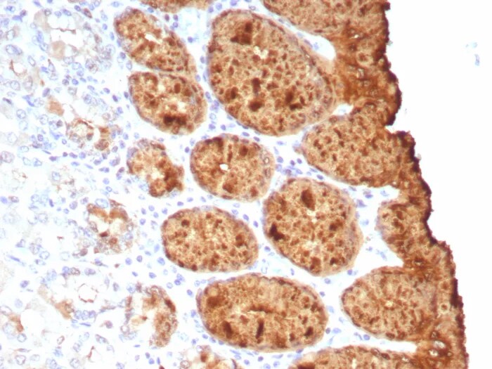 TAG-72 Antibody (rTAG72/9132) - Azide and BSA Free Immunohistochemistry-Paraffin: TAG-72 Antibody (rTAG72/9132) - Azide and BSA Free [NBP3-23987] -