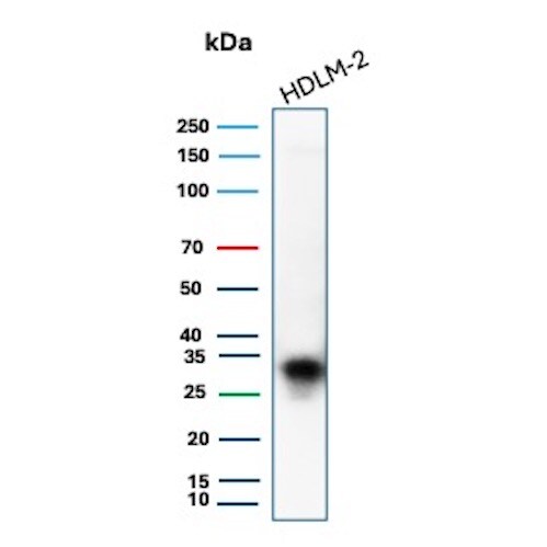 HLA DQ/DR/DP Antibody (rHLA-Pan/8847) - Azide and BSA Free Western Blot: HLA DQ/DR/DP Antibody (rHLA-Pan/8847) - Azide and BSA Free [NBP3-24001] -