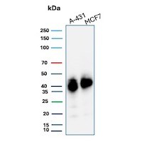 TROP-2 Antibody (TACSTD2/7349R) - Azide and BSA Free Western Blot: TROP-2 Antibody (TACSTD2/7349R) - Azide and BSA Free [NBP3-24007] -