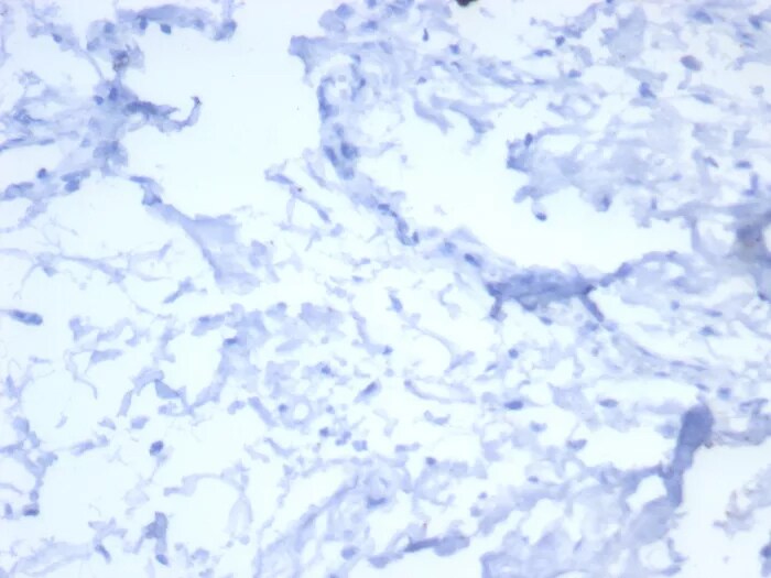 ErbB2/Her2 Antibody (ERBB2/7158R) - Azide and BSA Free Immunohistochemistry-Paraffin: ErbB2/Her2 Antibody (ERBB2/7158R) - Azide and BSA Free [NBP3-24037] -
