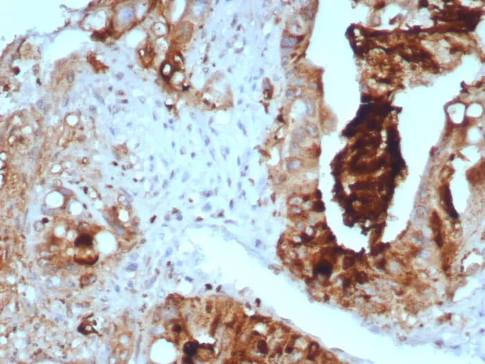 TAG-72 Antibody (TAG72/8317R) - Azide and BSA Free Immunohistochemistry-Paraffin: TAG-72 Antibody (TAG72/8317R) - Azide and BSA Free [NBP3-24049] -