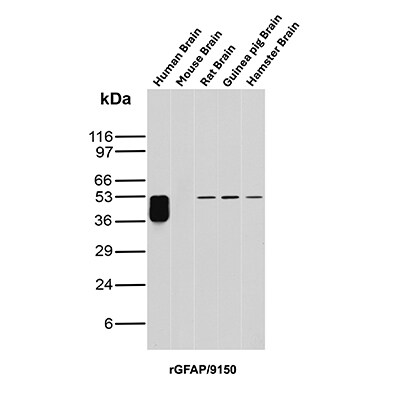 GFAP Antibody (rGFAP/9150) - Azide and BSA Free Western Blot: GFAP Antibody (rGFAP/9150) - Azide and BSA Free [NBP3-24050] -