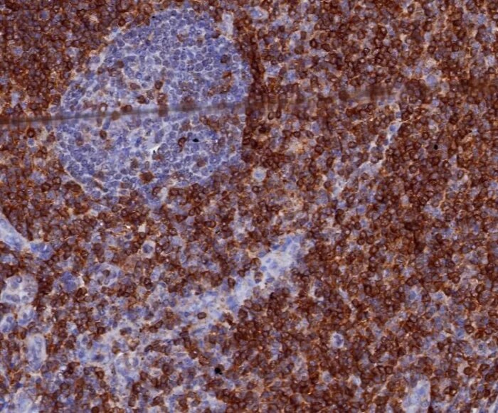 CD7 Antibody (CD7/3868R) - Azide and BSA Free Immunohistochemistry-Paraffin: CD7 Antibody (CD7/3868R) - Azide and BSA Free [NBP3-24056] -