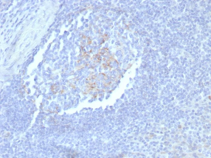 CD23/Fc epsilon RII Antibody (FCER2/8235R) - Azide and BSA Free Immunohistochemistry-Paraffin: CD23/Fc epsilon RII Antibody (FCER2/8235R) - Azide and BSA Free [NBP3-24058] -