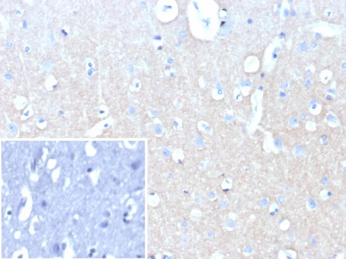 L1CAM Antibody (L1CAM/9146R) - Azide and BSA Free Immunohistochemistry-Paraffin: L1CAM Antibody (L1CAM/9146R) - Azide and BSA Free [NBP3-24102] -