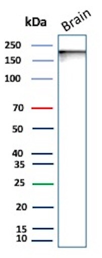 L1CAM Antibody (L1CAM/9146R) - Azide and BSA Free Western Blot: L1CAM Antibody (L1CAM/9146R) - Azide and BSA Free [NBP3-24102] -