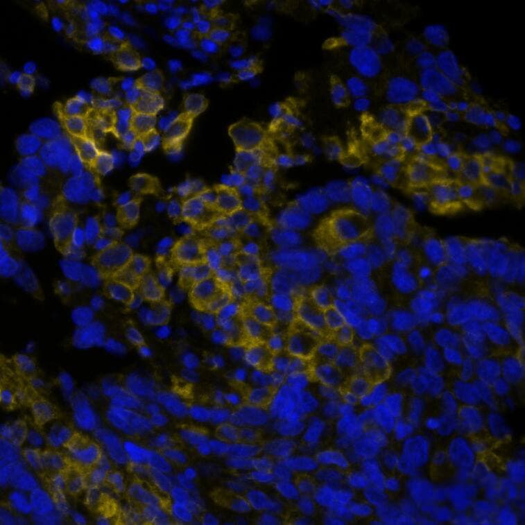 PD-L1 Antibody (PDL1/8809R) - Azide and BSA Free PD-L1 Antibody (PDL1/8809R) PD-L1 in Human Lung Tumor via seqIF� staining on COMET�