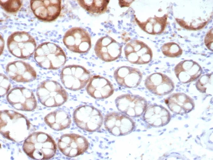 TFF1/pS2 Antibody (TFF1/8817R) - Azide and BSA Free Immunohistochemistry-Paraffin: TFF1/pS2 Antibody (TFF1/8817R) - Azide and BSA Free [NBP3-24123] -