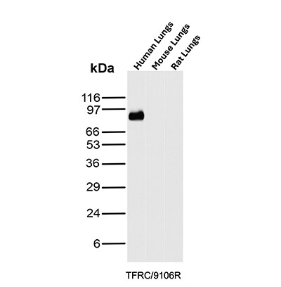 TfR (Transferrin R) Antibody (TFRC/9106R) - Azide and BSA Free Western Blot: TfR (Transferrin R) Antibody (TFRC/9106R) - Azide and BSA Free [NBP3-24124] -
