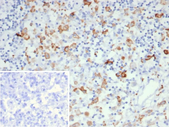 CD163L1 Antibody (CD163L1/7971) - Azide and BSA Free Immunohistochemistry-Paraffin: CD163L1 Antibody (CD163L1/7971) - Azide and BSA Free [NBP3-24128] -