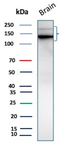 L1CAM Antibody (L1CAM/9267R) - Azide and BSA Free Western Blot: L1CAM Antibody (L1CAM/9267R) - Azide and BSA Free [NBP3-24129] -