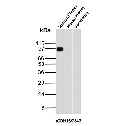 Cadherin-16 Antibody (rCDH16/7343) - Azide and BSA Free Western Blot: Cadherin-16 Antibody (rCDH16/7343) - Azide and BSA Free [NBP3-24130] -